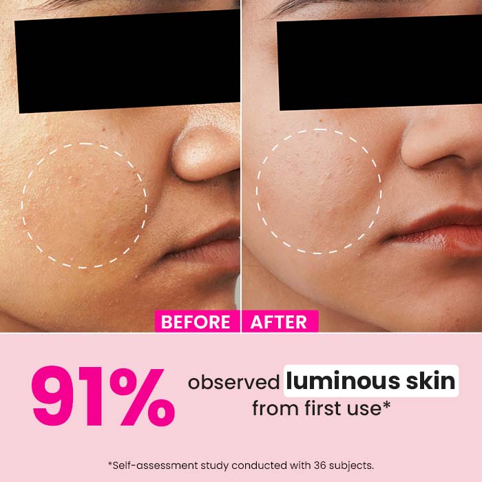 Watermelon & 10% Glycolic Serum